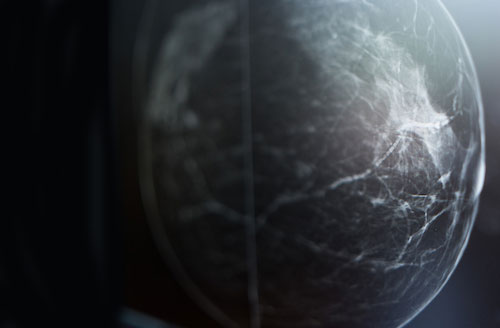 Patient Imaging at Penn Medicine, Breast Imaging Division